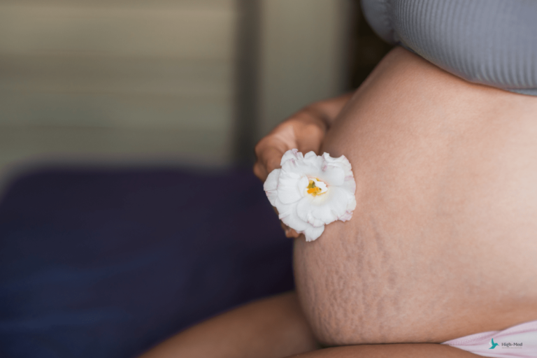 Rozstępy w ciąży - jak sobie z nimi radzić?